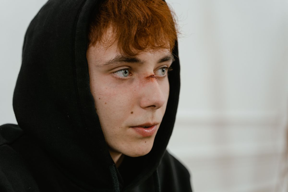 heridas falsas con maquillaje