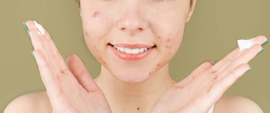 Cómo maquillar piel con acné