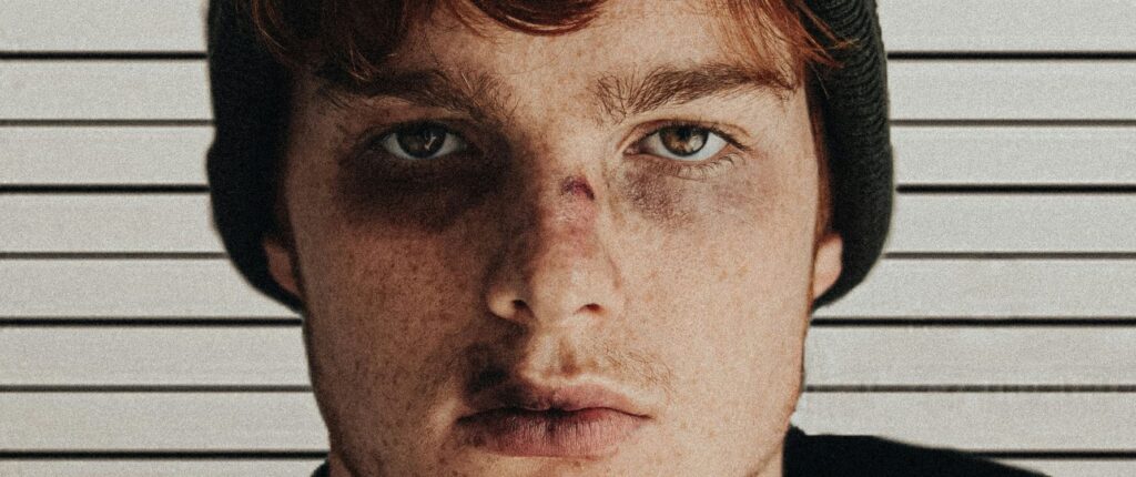 Cómo hacer moretones con maquillaje