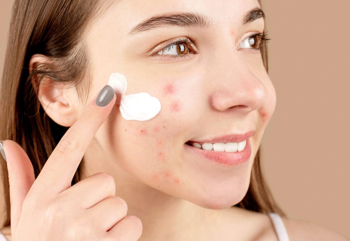 maquillar piel con acné